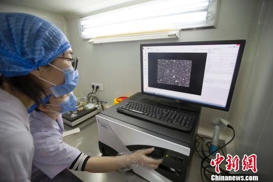 山西省精子库举行“开放日”,女大学生在观看精子的活性。 张云 摄 山西省精子库举行“开放日”,女大学生在观看精子的活性。 张云 摄