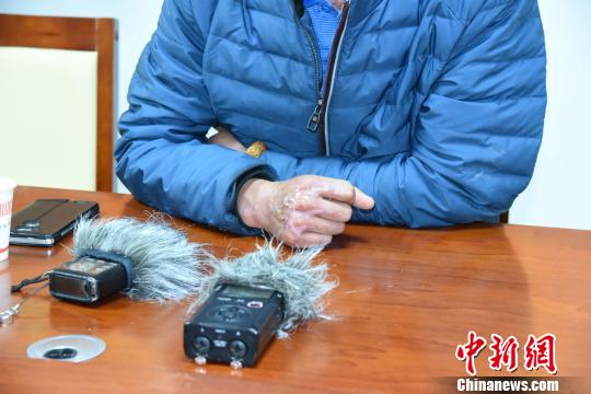 杨林的右手上留下了明显的伤疤 钟欣 摄 杨林的右手上留下了明显的伤疤 钟欣 摄
